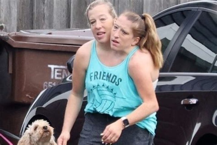 Abby And Brittany's Separated Fate