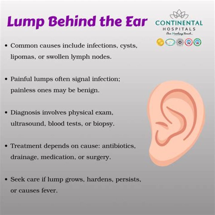 Cillian Murphy's Mysterious Lump Behind Ear: Explained