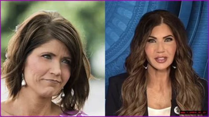  Discover The Transformation: Kristi Noem Before Plastic Surgery Revealed! 