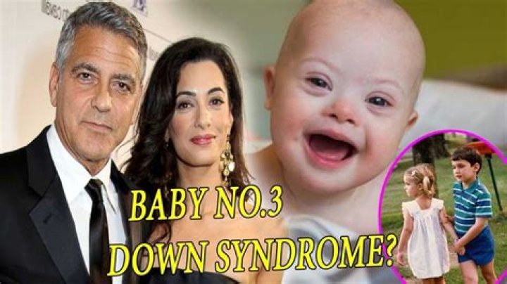 Does George Clooney's Twin Have Down Syndrome?