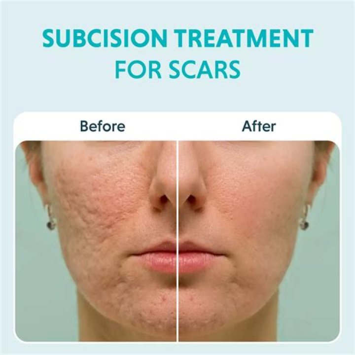 Effective Cover-Up: Eliminating Seal Scars On The Face