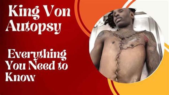 Graphic Autopsy Photos Of King Von: A Cautionary Tale