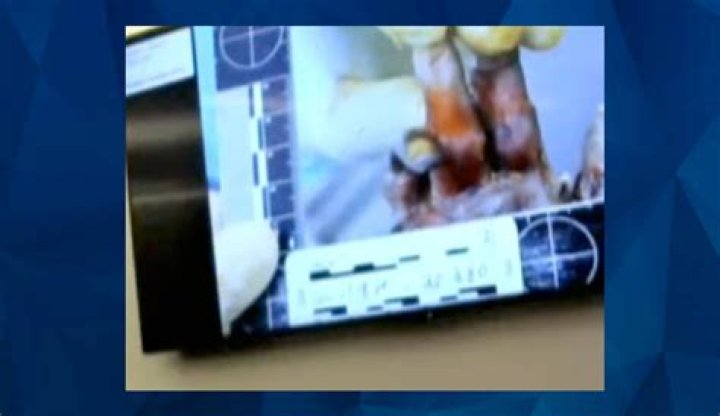 Gruesome Evidence: Gannon Stauch Autopsy Photos Revealed