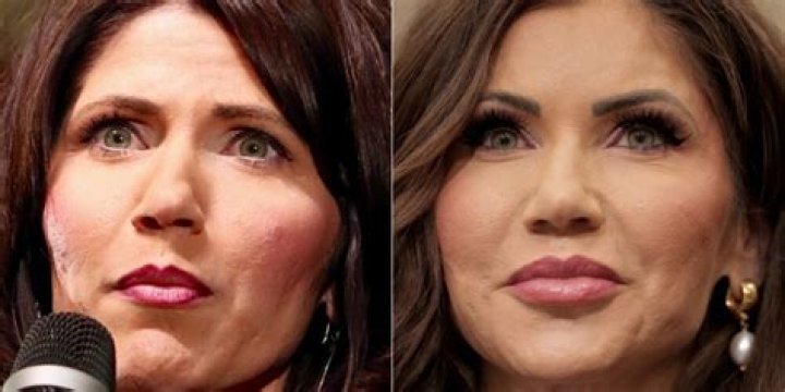 Has Kristi Noem Had Plastic Surgery? Rumors And Speculations