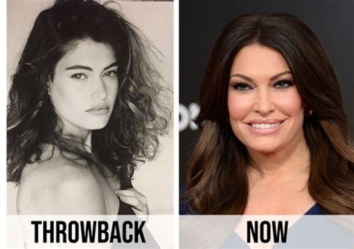 Kimberly Guilfoyle's Plastic Surgery Journey: A Comprehensive Guide
