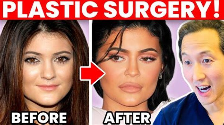 Kimberly Guilfoyle: Uncovering The Dramatic Transformation Before And After Plastic Surgery