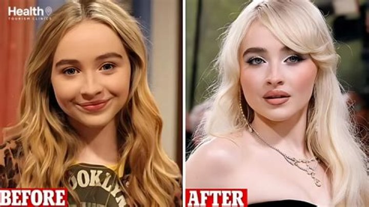 Sabrina Carpenter: A Glimpse Before Botox