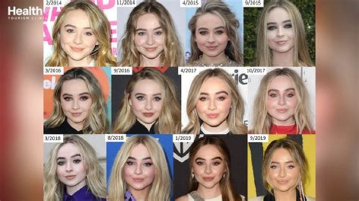 Sabrina Carpenter: A Look Into Her Plastic Surgery Journey Before And After