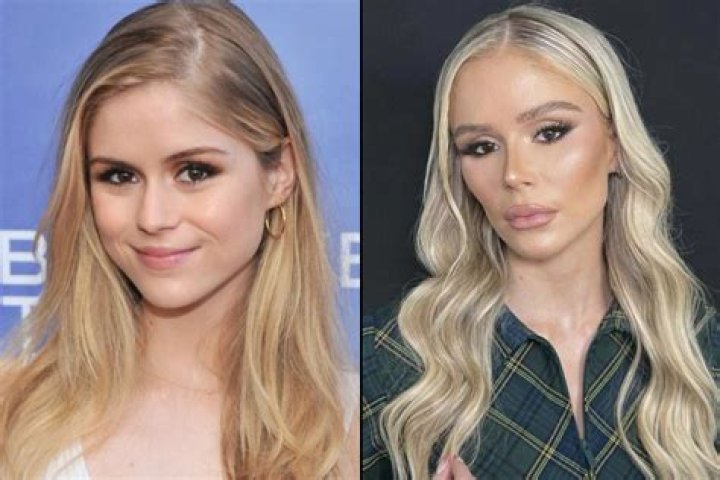 The Shocking Transformation Of Heidi And Spencer Before Plastic Surgery