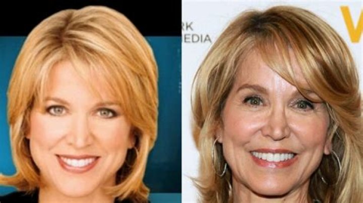 The Truth About Paula Zahn's Plastic Surgery: Before And After