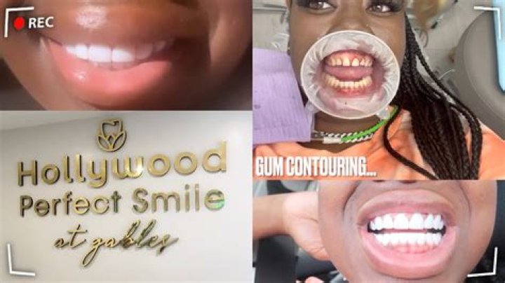 The Ultimate Guide To Chip Gaines' Teeth: Uncovering His Hollywood-Perfect Smile
