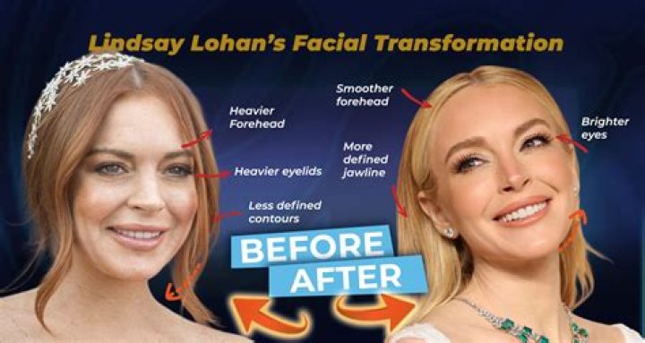 Unravelling The Unveiled: Did Lindsay Lohan Share A Twin Sibling?