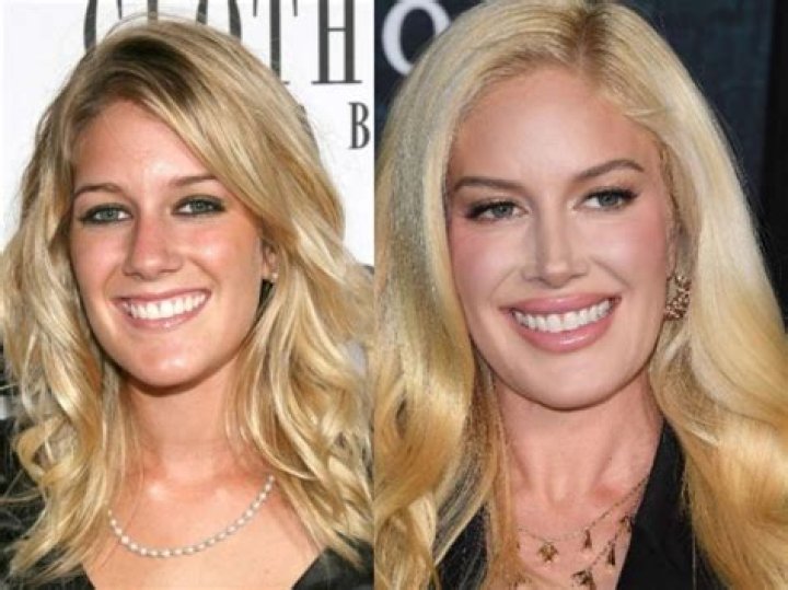 Unrecognizable! The Startling Transformation Of Heidi Montag Before And After