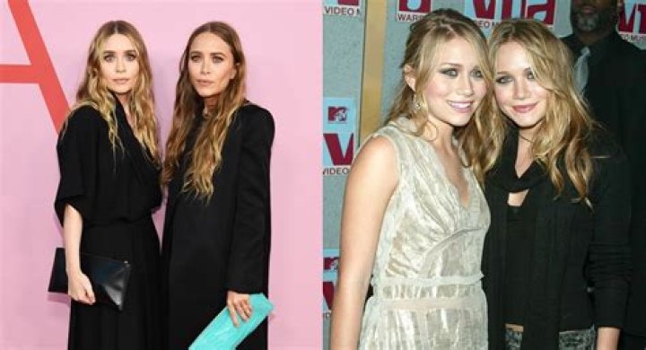 Unveiling The Mystery Of The Olsen Twins Buccal Fat