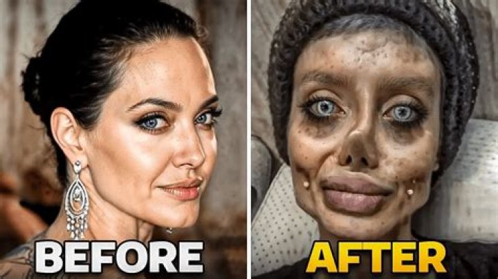 Unveiling The Truth Behind Botched Surgeries: Insights From Reddit