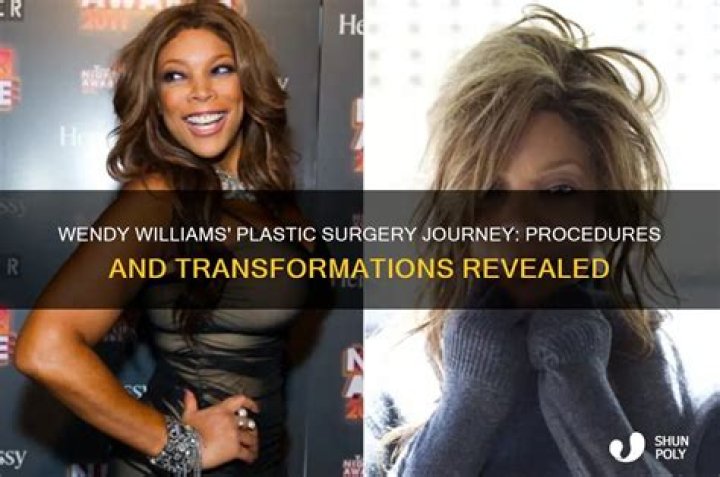 Wendy Williams' Plastic Surgery Journey: Uncovering Surprising Truths